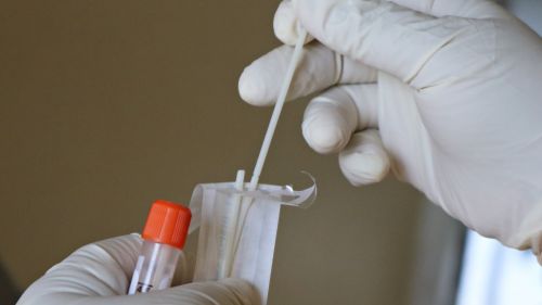 A lab technician holding a COVID-19 swab test